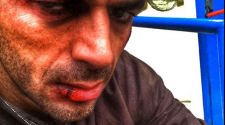 Luca Argentero
